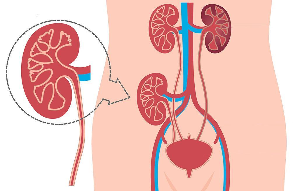 Projet de Transplantation Rénale